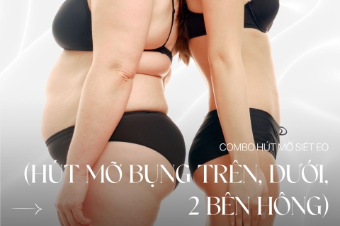 Combo Hút mỡ siết eo (hút mỡ bụng trên, dưới, 2 bên hông)